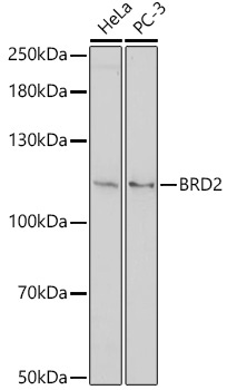BRD2 Rabbit Polyclonal Antibody