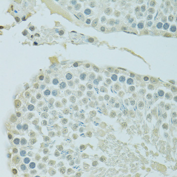 BRD3 Rabbit Polyclonal Antibody - Image 2