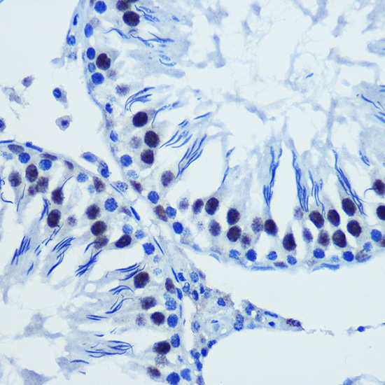 BRD4 Rabbit Polyclonal Antibody - Image 2