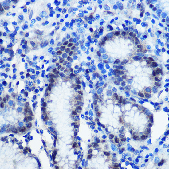 BRD4 Rabbit Polyclonal Antibody - Image 3