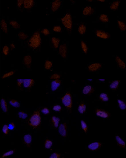 BRE Rabbit Polyclonal Antibody - Image 2