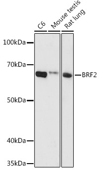 BRF2 Rabbit Polyclonal Antibody