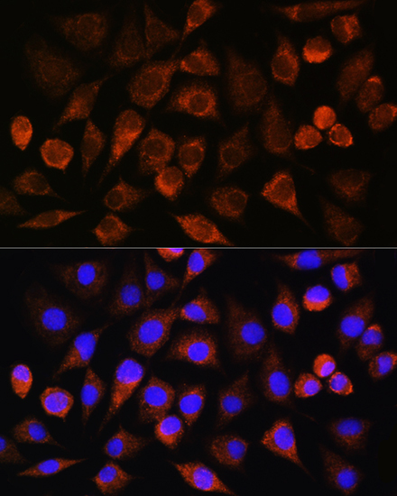 BRINP3 Rabbit Polyclonal Antibody - Image 2