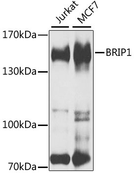 BRIP1 Rabbit Polyclonal Antibody