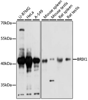 BRIX1 Rabbit Polyclonal Antibody
