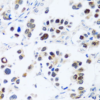BRIX1 Rabbit Polyclonal Antibody - Image 2
