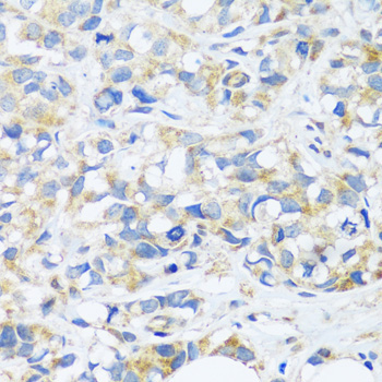 BRK1 Rabbit Polyclonal Antibody