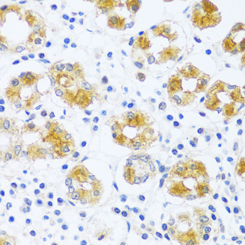 BRK1 Rabbit Polyclonal Antibody - Image 2