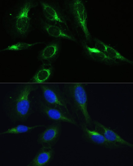 BRK1 Rabbit Polyclonal Antibody - Image 3