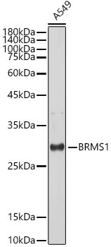 BRMS1 Rabbit Monoclonal Antibody