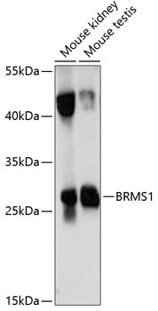 BRMS1 Rabbit Polyclonal Antibody