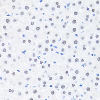 BRMS1 Rabbit Polyclonal Antibody - Image 2
