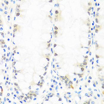 BRMS1 Rabbit Polyclonal Antibody - Image 3