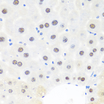 BRMS1 Rabbit Polyclonal Antibody - Image 4