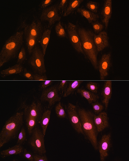 BRMS1 Rabbit Polyclonal Antibody - Image 5