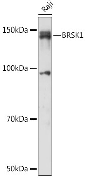 BRSK1 Rabbit Polyclonal Antibody
