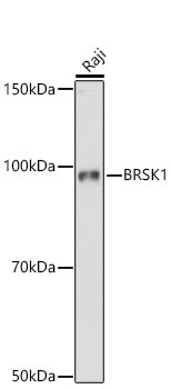 BRSK1 Rabbit Polyclonal Antibody - Image 2