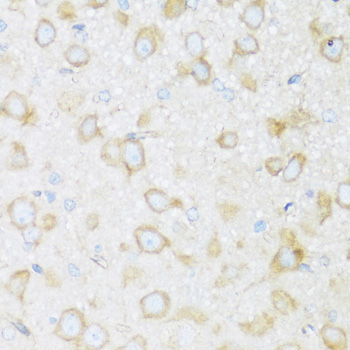 BRSK1 Rabbit Polyclonal Antibody - Image 3