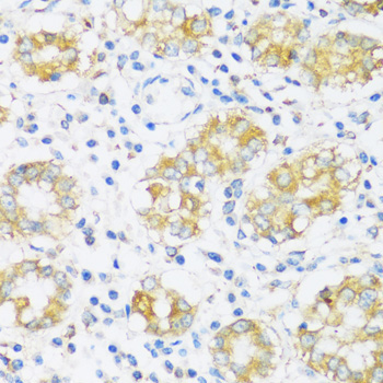 BRSK1 Rabbit Polyclonal Antibody - Image 4