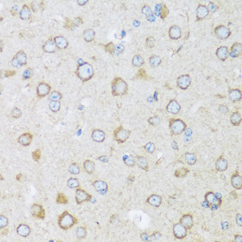 BRSK1 Rabbit Polyclonal Antibody - Image 5