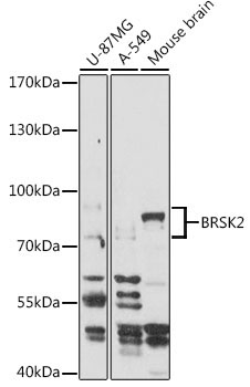 BRSK2 Rabbit Polyclonal Antibody