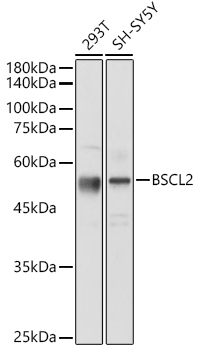BSCL2 Rabbit Polyclonal Antibody