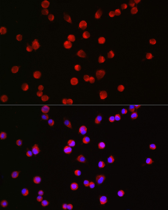 BSN Rabbit Polyclonal Antibody
