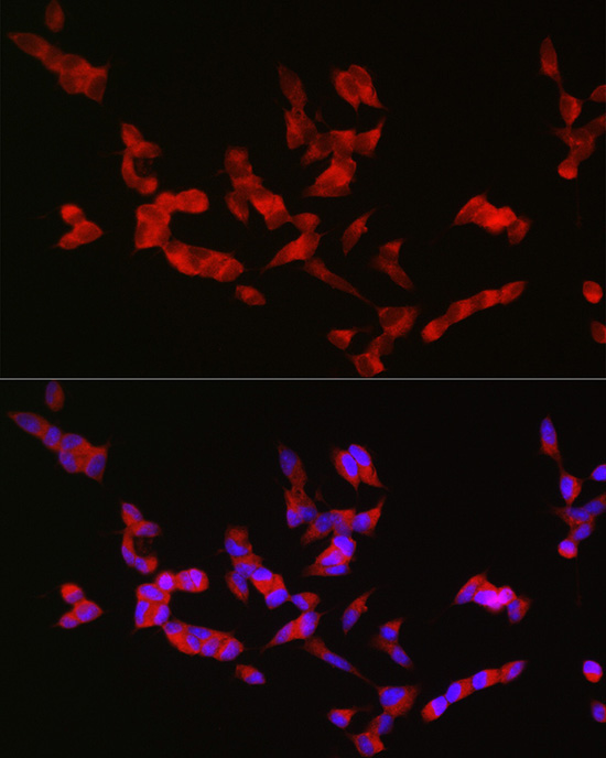 BSN Rabbit Polyclonal Antibody - Image 2