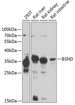 BSND Rabbit Polyclonal Antibody