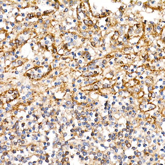 BST2 Rabbit Polyclonal Antibody - Image 3