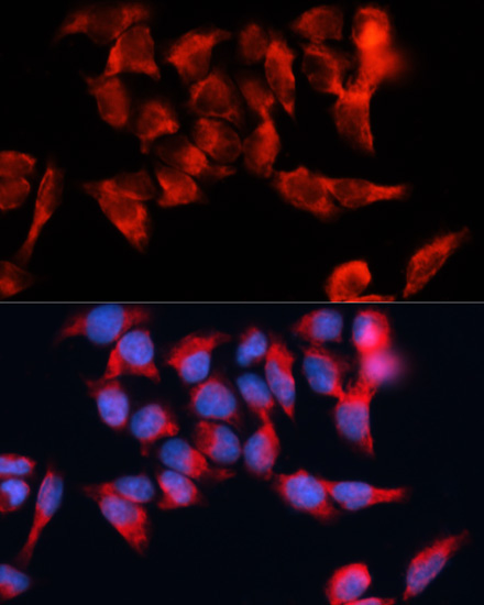 BST2 Rabbit Polyclonal Antibody - Image 4