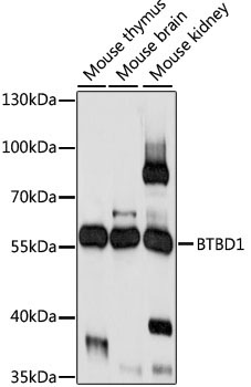 BTBD1 Rabbit Polyclonal Antibody