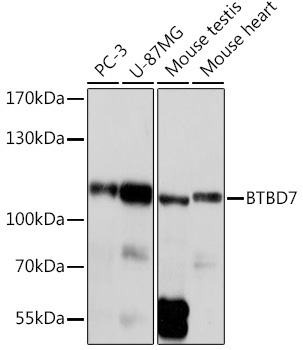BTBD7 Rabbit Polyclonal Antibody