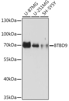 BTBD9 Rabbit Polyclonal Antibody