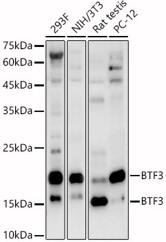 BTF3 Rabbit Polyclonal Antibody