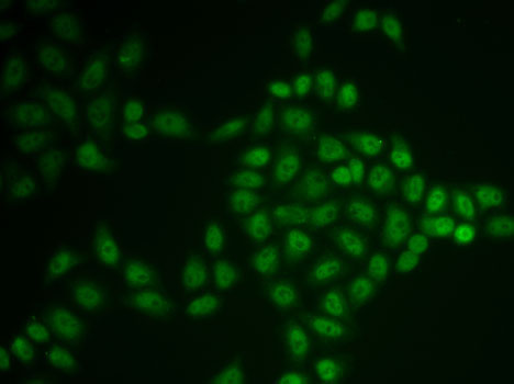 BTG1 Rabbit Polyclonal Antibody