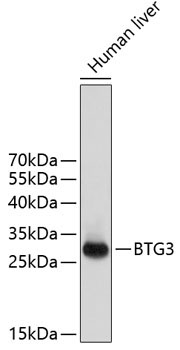 BTG3 Rabbit Polyclonal Antibody