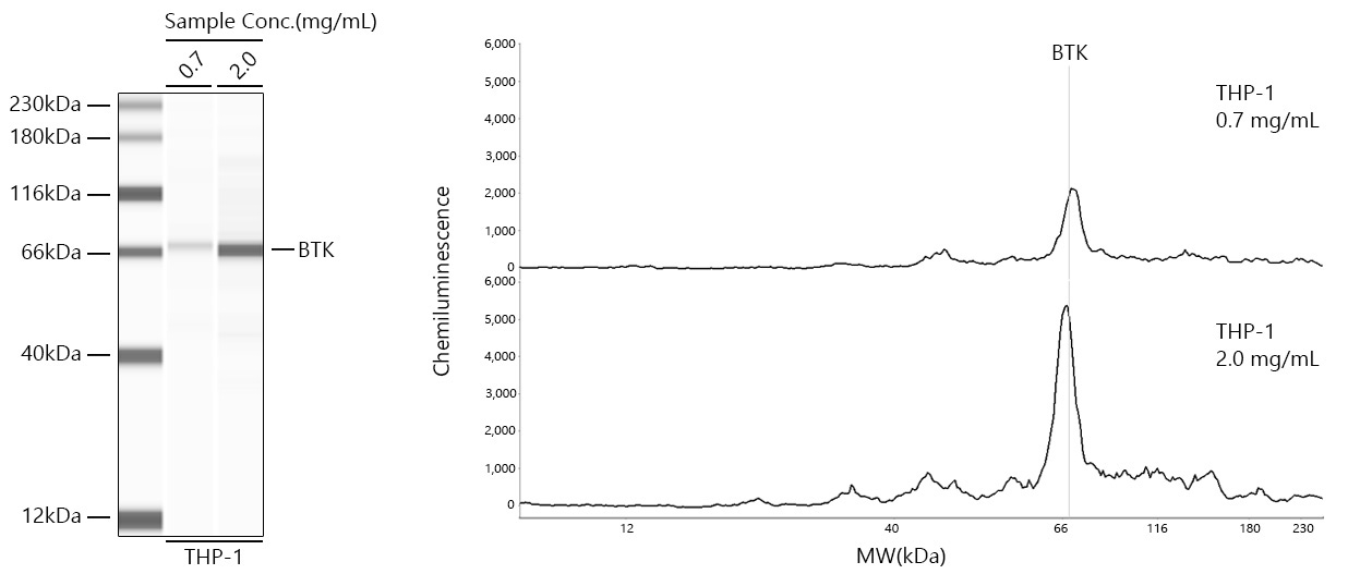 BTK Rabbit Monoclonal Antibody