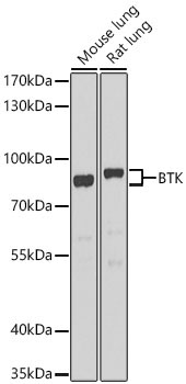 BTK Rabbit Polyclonal Antibody - Image 2