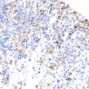 BTK Rabbit Polyclonal Antibody - Image 2