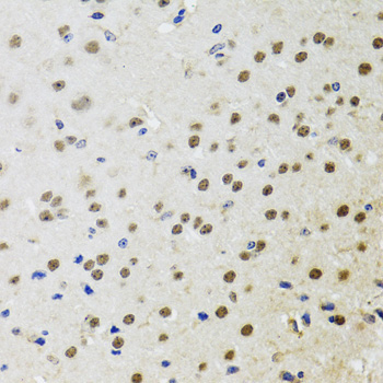 BTK Rabbit Polyclonal Antibody - Image 3