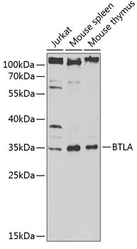 BTLA Rabbit Polyclonal Antibody