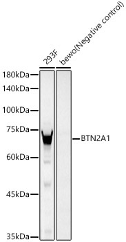 BTN2A1 Rabbit Monoclonal Antibody
