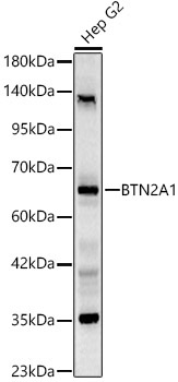 BTN2A1 Rabbit Polyclonal Antibody