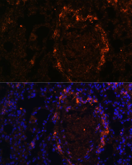 BTN3A1 Rabbit Polyclonal Antibody - Image 2