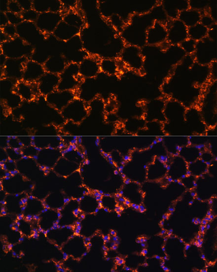 BTN3A1 Rabbit Polyclonal Antibody - Image 3