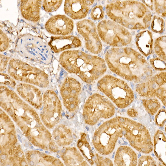 BTNL2 Rabbit Polyclonal Antibody - Image 2