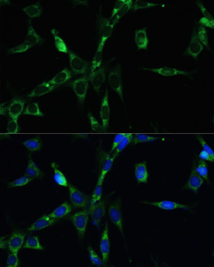 BUB1B Rabbit Polyclonal Antibody - Image 2