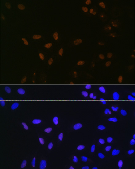 BUB3 Rabbit Monoclonal Antibody - Image 2