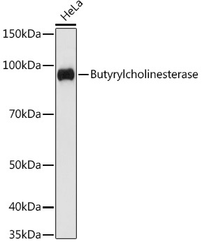 Butyrylcholinesterase Rabbit Monoclonal Antibody